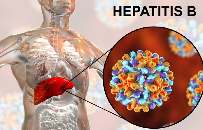 Hepatitis B Virus Infection