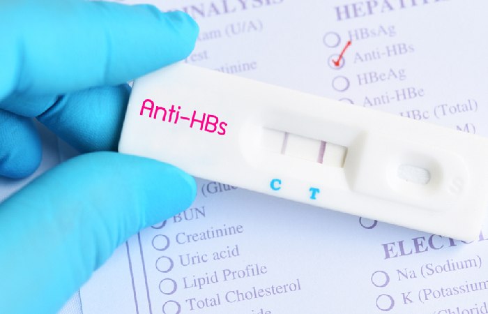 What are Anti HBs?